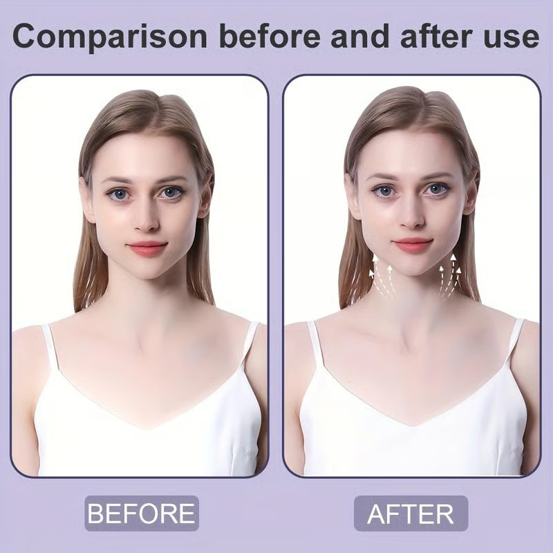 Before and after comparison of a woman in a white camisole, with arrows on the after image showing the neck lifted. 4