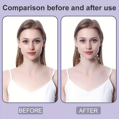 Before and after comparison of a woman in a white camisole, with arrows on the after image showing the neck lifted. 4