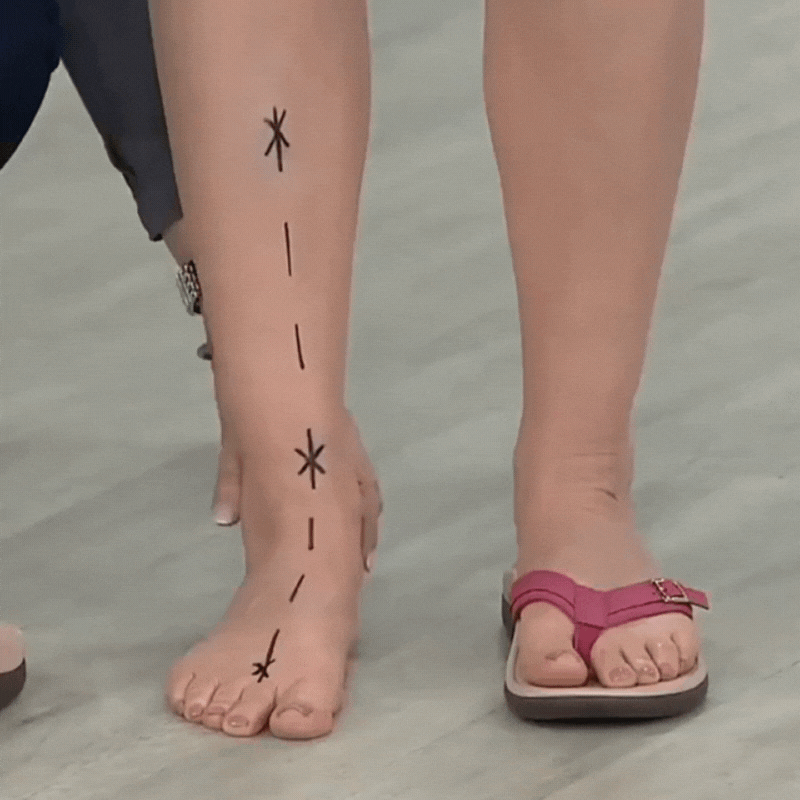 Bare foot marked with dashed lines beside a foot in a pink thong sandal 13