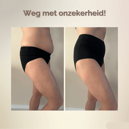Side-by-side side-view comparison of a woman's midsection in black high-waisted briefs, showing a smoother, flatter silhouette in the right-hand image. 2